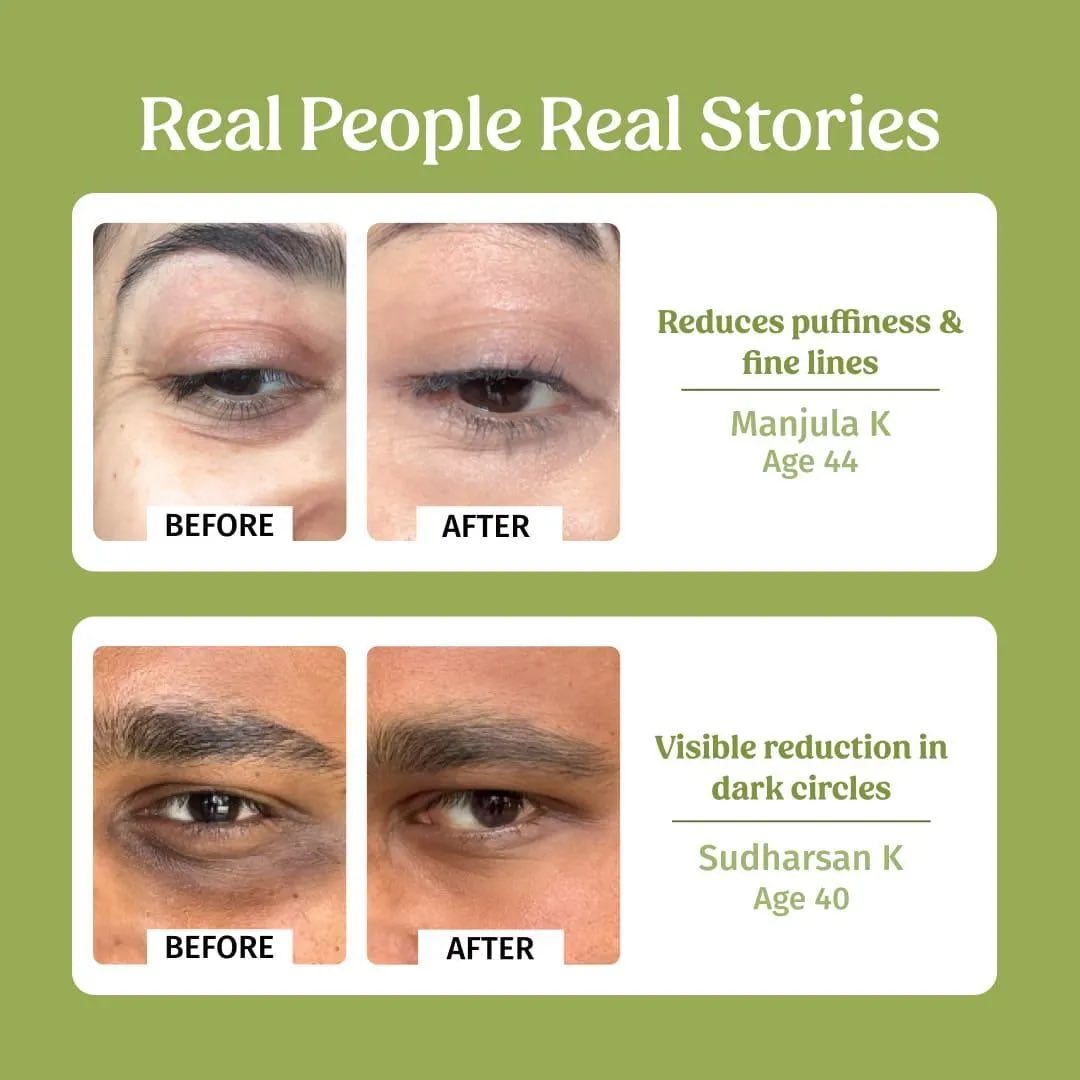 Dark circle brightening color corrector before and after under eyes