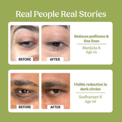 Dark circle brightening color corrector before and after under eyes
